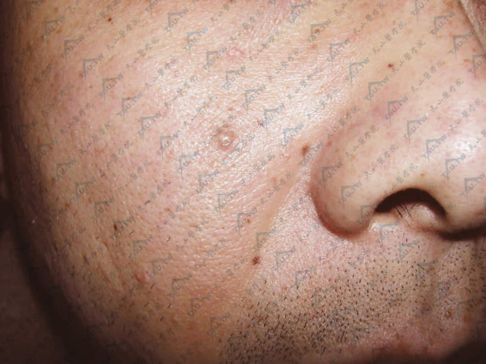 どのような治療法がありますか?