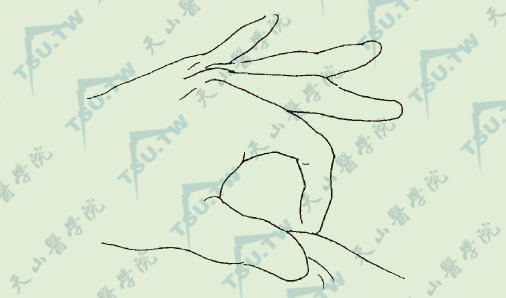 脂肪抽吸后