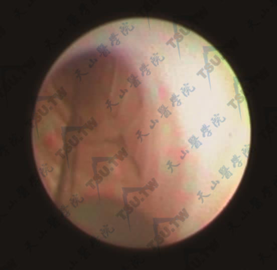 射精管
